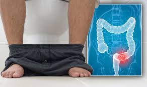 In many cases, a cancerous lump feels firm to the touch, according to health magazine. Bowel Cancer Symptoms Should Poo Be Soft Or Hard What A Healthy Stool Looks Like Express Co Uk