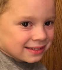 Dealing with armchair experts