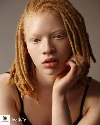 alice uhuru image result for albino rastas naturliche frisuren haarschonheit dreadlocks