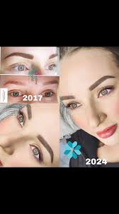 Profile for Suzanne Wylde Permanent Cosmetics & Medical Micropigmentation