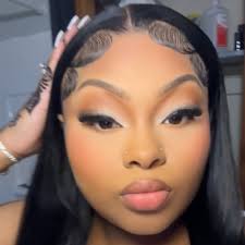 What are effective treatments for hyperpigmentation?