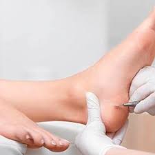 Adicional Bisturí / Tratamiento / Torno