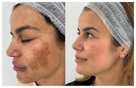 Compra y Venta en guardalavaca Cuba