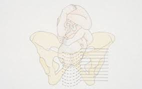 How do i know if baby is engaged in pelvis? When A Baby Drops During Pregnancy