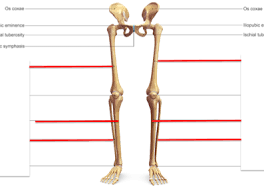 Quiz Worksheet Lower Limb Bones Study Com