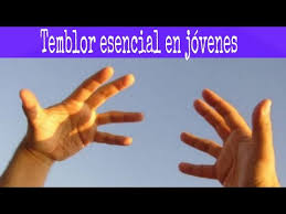 Temblor esencial by gregorio fonten, released 26 november 2013 1. Temblor Esencial En Jovenes Y Ninos Youtube