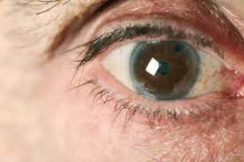 خزانة الموارد البشرية تاجر Ring Um Die Augen Hotelsanaasinn Com