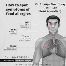 Food Allergies Don T Just Show Their Effects On The Stomach They Manifest In Other Ways Too Book Your Consul Itching Skin Allergy Eyes Online Consultation