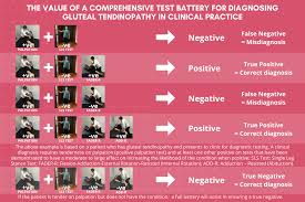 Image result for Resisted External Derotation Test