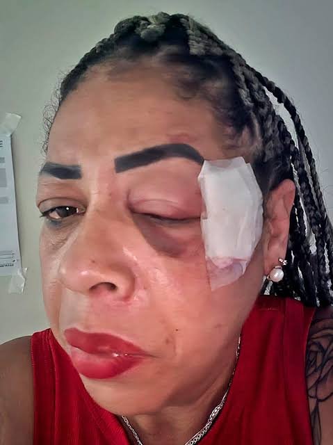 Mulher &eacute; atropelada durante comemora&ccedil;&atilde;o da vit&oacute;ria de Lula em C&aacute;ceres - PORTAL MATO GROSSO
