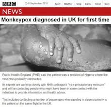 Dopo che un ufficiale della marina nigeriana, recatosi in. Vaiolo Delle Scimmie Primo Caso In Inghilterra Come Si Manifesta