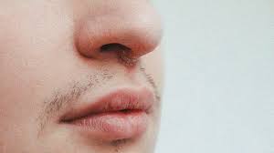 We did not find results for: Cold Sore Under Nose Symptoms Causes Treatments And More