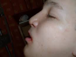 Christopher Williams is fundraising for Cleft Lip And Palate Association