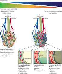 4 episodes, 20 levels in each episode, that is, a total of 80 levels (all unlocked by default) realistic physics of drawing a. The Covid 19 Puzzle Deciphering Pathophysiology And Phenotypes Of A New Disease Entity The Lancet Respiratory Medicine