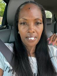 Dental crown recovery time for flute playing