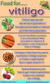 Food For Vitiligo Vitiligo Vitiligo Diet Vitiligo Cure