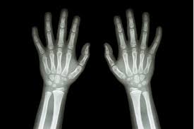 Image result for Growth Plate