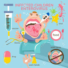 There is no specific treatment for hand, foot, and mouth disease. Infected Children Enterovirus Hand Foot Mouth Disease Infographics Royalty Free Cliparts Vectors And Stock Illustration Image 104820860
