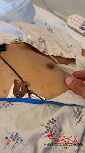 Image result for Point of Maximum Impulse