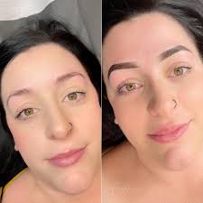 It's great to see my clients beautiful smiles again 😊🔥 . . . . . . . . .  . . . #microblading #microbladingbrows #microneedling #semipermanentbrows  #cosmetics #ottawa #cosmetictattoo #microbladingeyebrows  #microbladingottawa #ottawamicroblading #