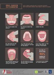 Your treatment choices depend on the type of oral cancer you have, test results, and the stage many people feel worried, depressed, and stressed when dealing with cancer. Cancer Society Of Maldives On Twitter April Is Oralcancer Awareness Month Do Your Oral Self Examinations Regularly Consult Your Dentist At Least Once A Year For Oral Cancer Screening Earlydetection Saves Lives