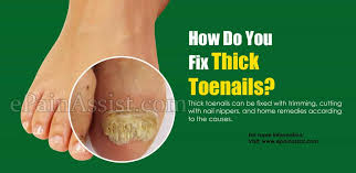 Check spelling or type a new query. How Do You Fix Thick Toenails