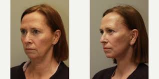 Hessler Plastic Surgery