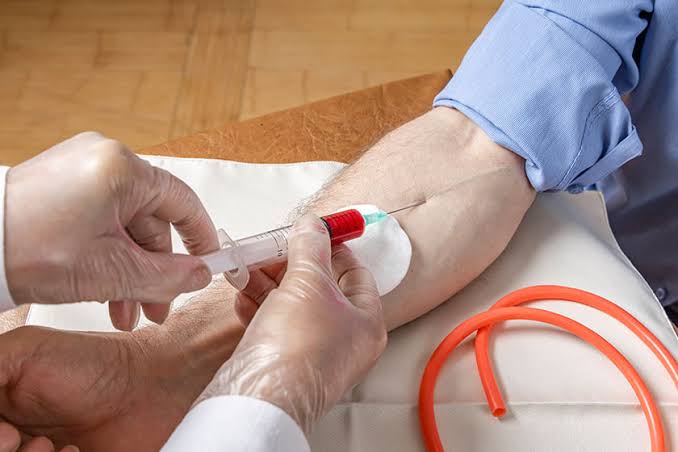 A Step-By-Step Guide to Phlebotomy Procedure | Phlebotomy USA