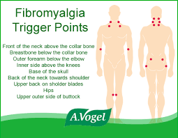 Symptoms Fibromyalgia Trigger Point Diagram Catalogue Of