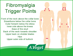 fibromyalgia trigger points