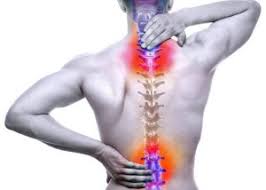 Image result for Spinal Trauma