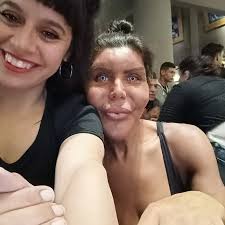 Ya teniendo l cejas tatuadas hoy fue el turno d l boca,1ra seción y obvio  está un poco inflamada,en l próximas seciones s viene color, gracias a m  amiga @sararamirezmakeup x esté