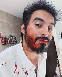 Jose Luis Anaya (@joseluisanaya88) · Instagram 照片和视频