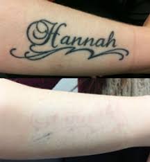 In order to give your skin time to fully heal between sessions. Laser Tattoo Removal Get Your Tattoo Removed