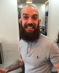 Tyldesley man shaving off beard to raise money for paralysed teen