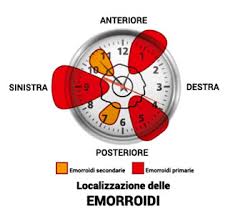 Emorroidi Cura Sintomi Cause Rimedi Prevenzione E Dieta