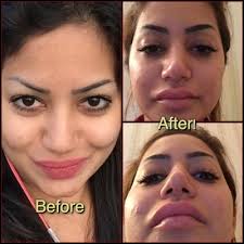 Terrible Experience with Dr Henry Mentz & His Coordinator !!! -...