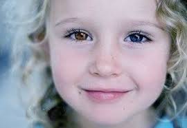 「オッドアイ」の画像検索結果