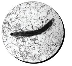 Pump pressure and temperature above 300 pounds per square inch and 85°f, respectively, will kill nematodes. Fighting Fungus Gnats With Parasitic Nematodes