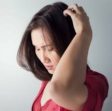 Image result for lice vs dandruff