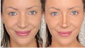 Alternate between smiling and going back to your resting face, pressing on your nose the whole time. Reshaping The Nose Beauty With Checked Nose Fillers