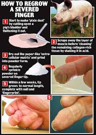 How To Regrow A Severed Finger Severed Finger Bladder Severe