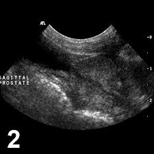 For dogs, the descent to the final scrotal position is expected to be complete by the time the puppy is two months old. Canine Cryptorchidism Clinician S Brief