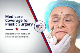 Medicare Coverage for Plastic Surgery