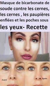 Pin On Pas De Vilaines Poches Sous Les Yeux Youppi
