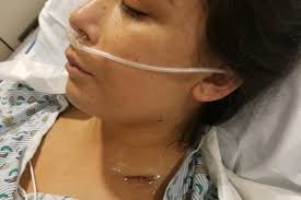 Fundraiser for Brittany Yee by Brittany Yee : Brittany's Battle Against  Lymphoma