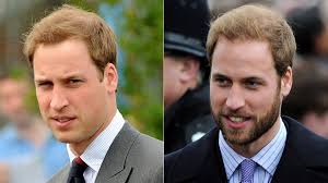5 Bearded Prince William Looks That Missed The Mark
