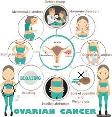 Learn about the signs and symptoms of ovarian cancer such as bloating, pelvic or abdominal (belly) pain, feeling full quickly, and urinary symptoms. Know These 10 Signs And Symptoms Of Ovarian Cancer One Tough B