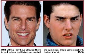 Maybe you would like to learn more about one of these? Tom Cruise Teeth Album On Imgur