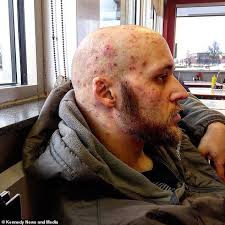 Essex 'party girl' claims transatlantic romance saved her life